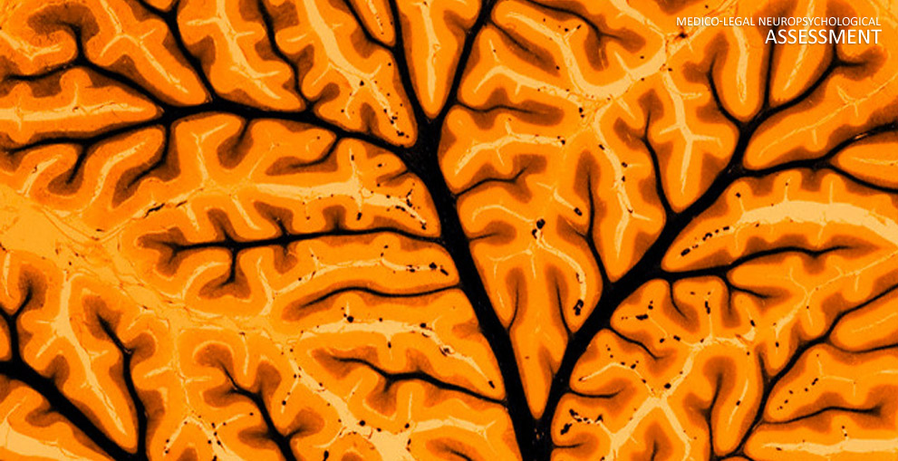 forensic neuropsychologist